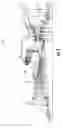 Fig. 03 - STATOR VANE SUPPORT SYSTEM WITHIN A GAS TURBINE ENGINE
