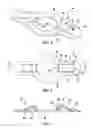 Fig. 03 - Lock washer