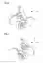 Fig. 05 - Device for guiding elongate object