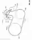 Fig. 21 - Orbital tensioner assembly