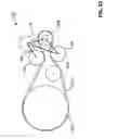Fig. 23 - Orbital tensioner assembly