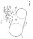 Fig. 25 - Orbital tensioner assembly