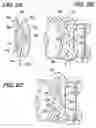 Fig. 04 - Valve coupling having centering support projections
