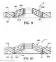Fig. 06 - Torque retention arrangement