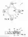 Fig. 10 - Torque retention arrangement