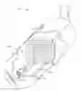 Fig. 01 - BURNER SYSTEM INCLUDING A MOVEABLE PERFORATED FLAME HOLDER