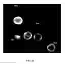 Fig. 21 - IMAGE ANALYSIS AND MEASUREMENT OF BIOLOGICAL SAMPLES