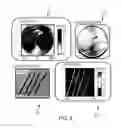 Fig. 08 - SINGLE CHANNEL TERAHERTZ ENDOSCOPY