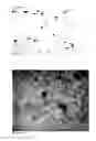 Fig. 07 - Device for high throughput detection of cervical disease