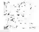 Fig. 08 - Device for high throughput detection of cervical disease