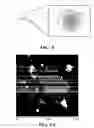 Fig. 17 - Functionalized graphene oxide system for detecting rare cells
