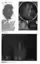 Fig. 28 - Agents and methods for determining colorectal cancer status
