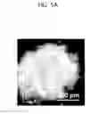 Fig. 11 - USE OF FLUOROQUINOLONE ANTIBIOTICS