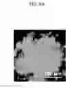 Fig. 16 - USE OF FLUOROQUINOLONE ANTIBIOTICS