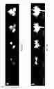 Fig. 06 - Dynamic contrast enhanced magnetic resonance imaging with flow encoding
