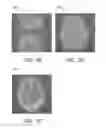 Fig. 04 - Multi-shot magnetic-resonance (MR) imaging system and method of operation thereof