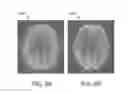Fig. 07 - Multi-shot magnetic-resonance (MR) imaging system and method of operation thereof