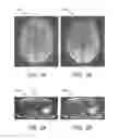 Fig. 08 - Multi-shot magnetic-resonance (MR) imaging system and method of operation thereof