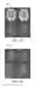 Fig. 12 - Multi-shot magnetic-resonance (MR) imaging system and method of operation thereof