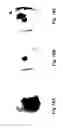 Fig. 15 - System and method for off angle three-dimensional face standardization for robust performance
