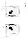 Fig. 17 - System and method for off angle three-dimensional face standardization for robust performance