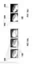 Fig. 57 - Connector for an optical fiber and combinations, kits, and methods of using the same