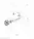 Fig. 04 - Vandal Proof Knob
