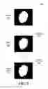Fig. 04 - Methods and systems for assigning pixels distance-cost values using a flood fill technique