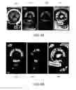 Fig. 08 - Identifying consumer products in images