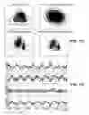Fig. 03 - SUBSPACE PROJECTION OF MULTI-DIMENSIONAL UNSUPERVISED MACHINE LEARNING MODELS