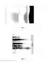 Fig. 02 - Tire image rectifying method