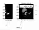 Fig. 07 - Systems and methods for detecting a fatty liver from a computed tomography (CT) scan