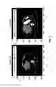 Fig. 08 - Systems and methods for detecting a fatty liver from a computed tomography (CT) scan