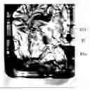 Fig. 01 - Image analysis apparatus, imaging system, surgery support system, image analysis method, storage medium, and detection system