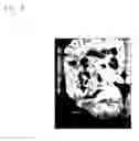 Fig. 07 - Image analysis apparatus, imaging system, surgery support system, image analysis method, storage medium, and detection system
