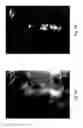 Fig. 05 - Anomaly detection in medical imagery