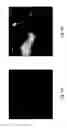 Fig. 06 - Anomaly detection in medical imagery