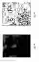 Fig. 07 - Anomaly detection in medical imagery