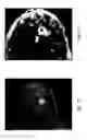 Fig. 08 - Anomaly detection in medical imagery