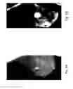 Fig. 09 - Anomaly detection in medical imagery
