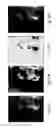 Fig. 11 - Anomaly detection in medical imagery