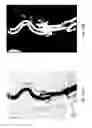 Fig. 13 - Anomaly detection in medical imagery
