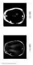 Fig. 15 - Anomaly detection in medical imagery