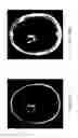 Fig. 16 - Anomaly detection in medical imagery
