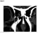 Fig. 05 - Method for cell envelope segmentation and visualisation