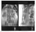 Fig. 01 - Imaging device for registration of different imaging modalities
