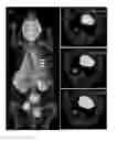 Fig. 01 - Bioluminescence tomography reconstruction based on multitasking bayesian compressed sensing