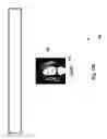 Fig. 131 - Neuroplasticity games for depression