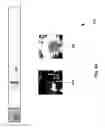 Fig. 47 - Neuroplasticity games for depression