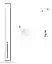 Fig. 67 - Neuroplasticity games for depression